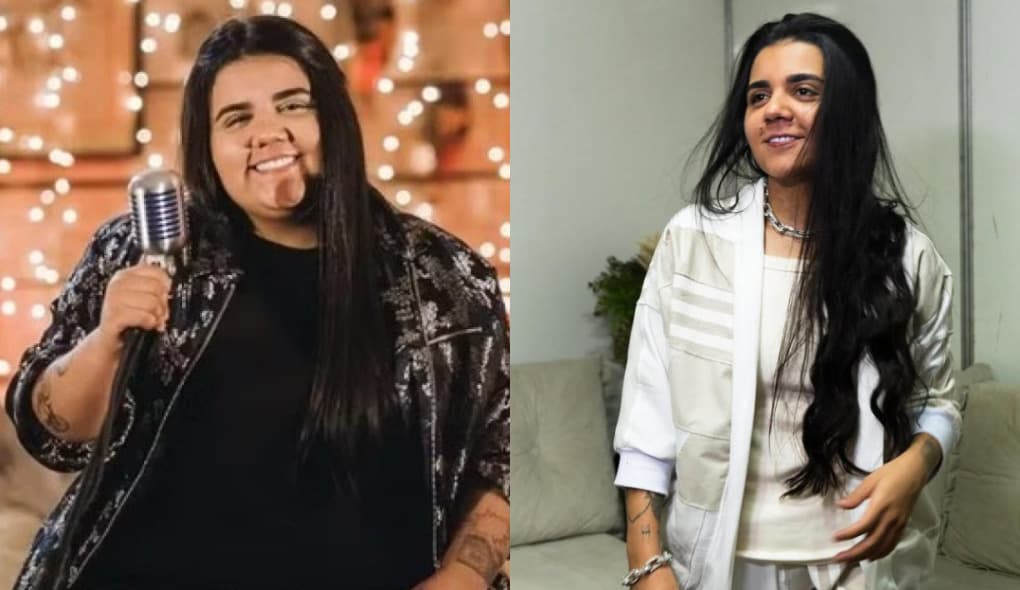 Médico aponta riscos da bariátrica da sertaneja Yasmin Santos: ‘Maiores chances’