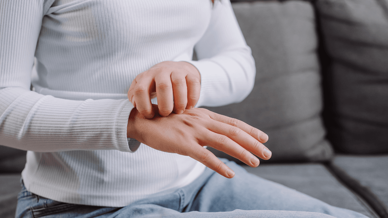 Disidrose: doença de pele frequente em jovens adultos pode piorar com o estresse emocional